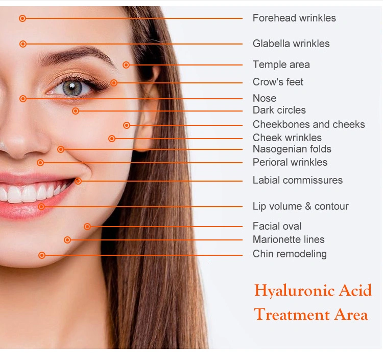 Cross-Linked Hyaluronic Acid Skin Care for Plastic Surgery Injectable Dermal Filler